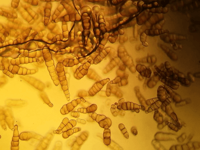 Alternaria brassicicola spores for diagnosis